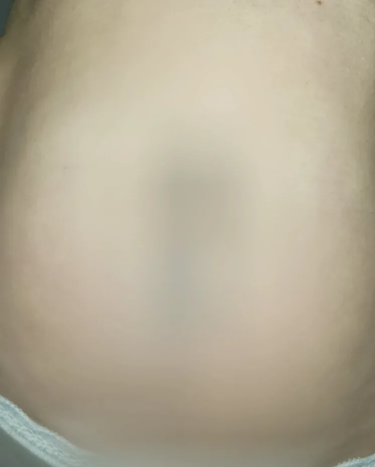 Nea, 29